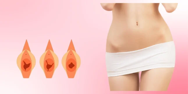 Hymenoplasty (Hymen Reconstruction Surgery)